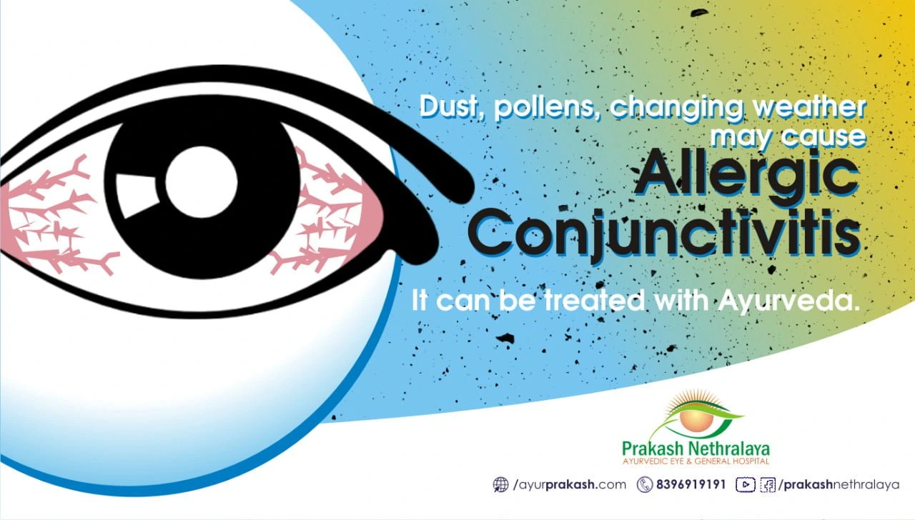 Allergic Conjunctivitis And Its Ayurvedic Treatment