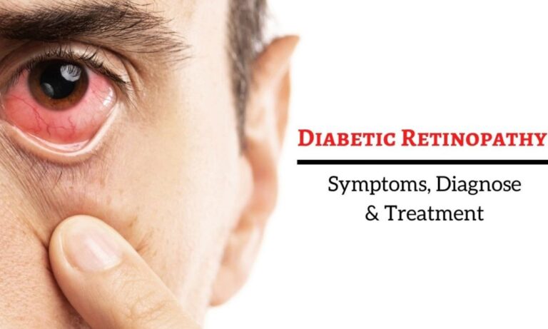 Diabetic Retinopathy Causes and Symptoms