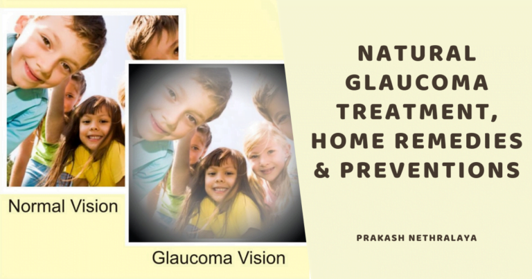 Natural Glaucoma Treatment, Home Remedies and Preventions