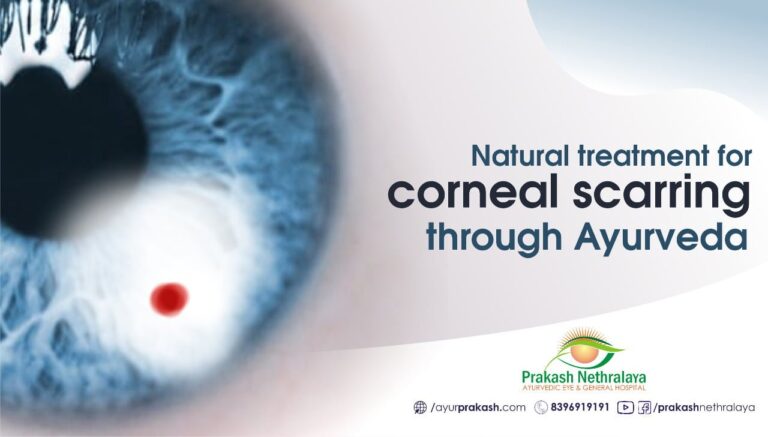 Natural Treatment For Corneal Scarring Through Ayurveda