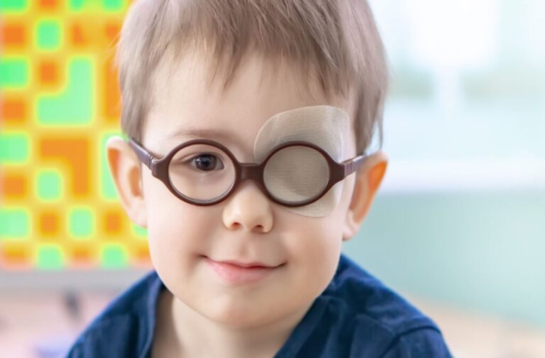 Ayurvedic Treatment of Amblyopia