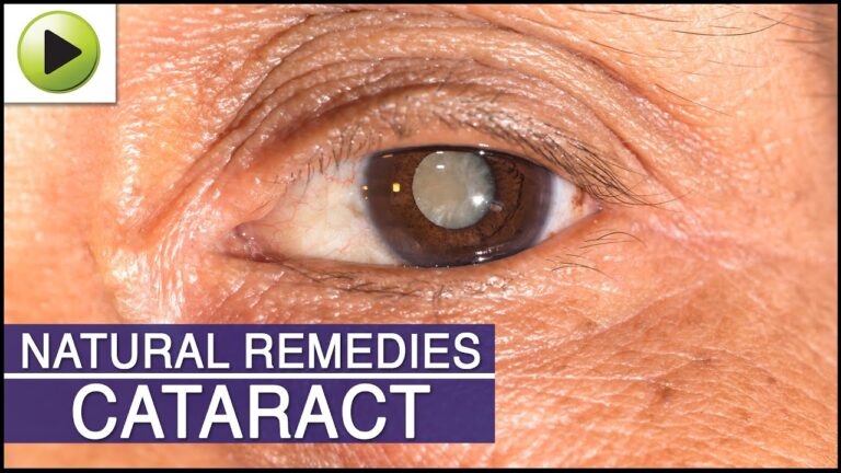 Cataract Non Surgical Treatment: The Most Serious Cases Treated
