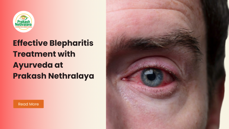 Effective Blepharitis Treatment with Ayurveda at Prakash Nethralaya