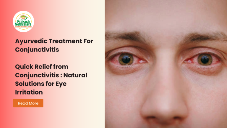 Quick Relief from Conjunctivitis : Natural Solutions for Eye Irritation