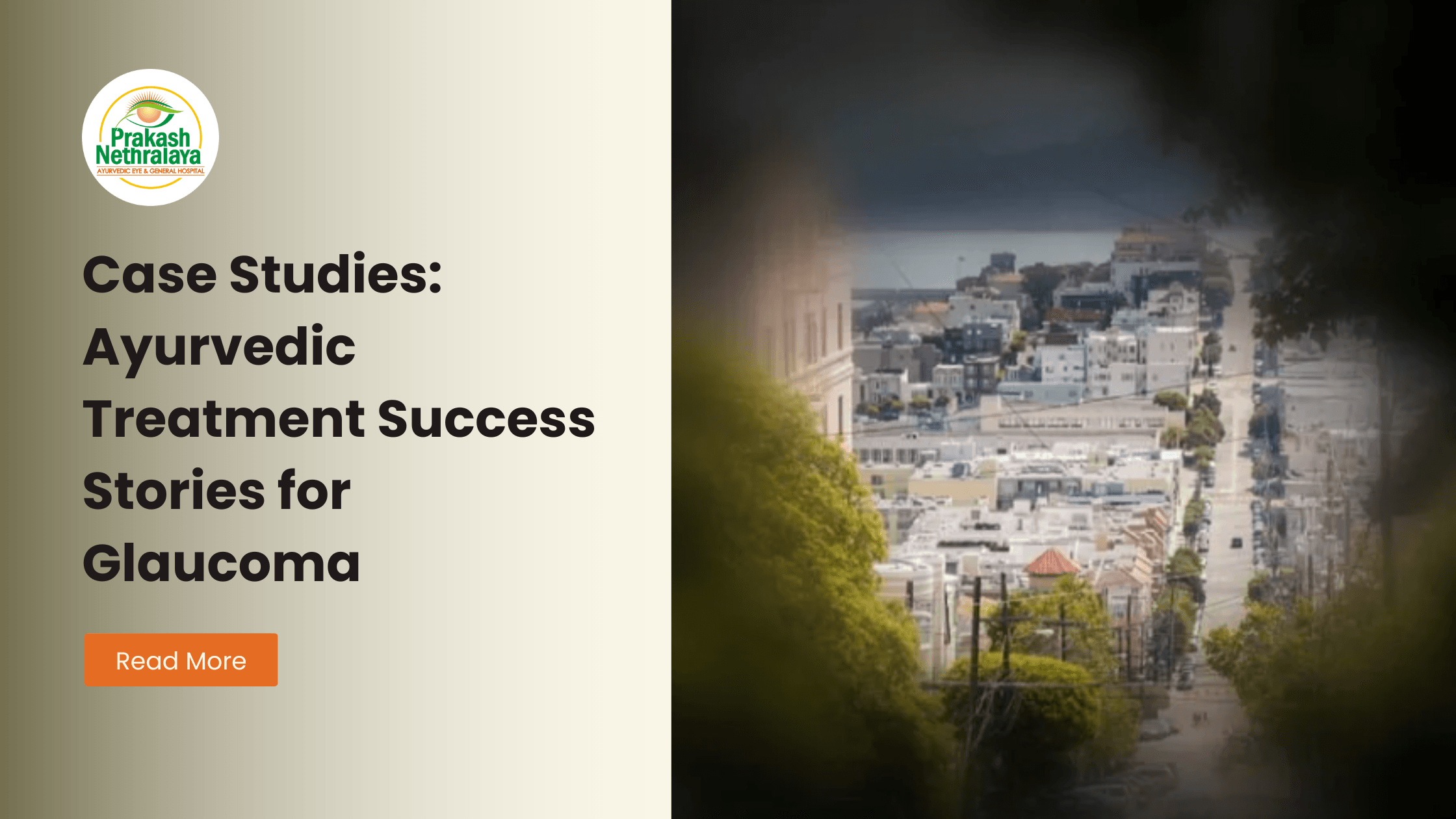 Ayurvedic treatment of glaucoma