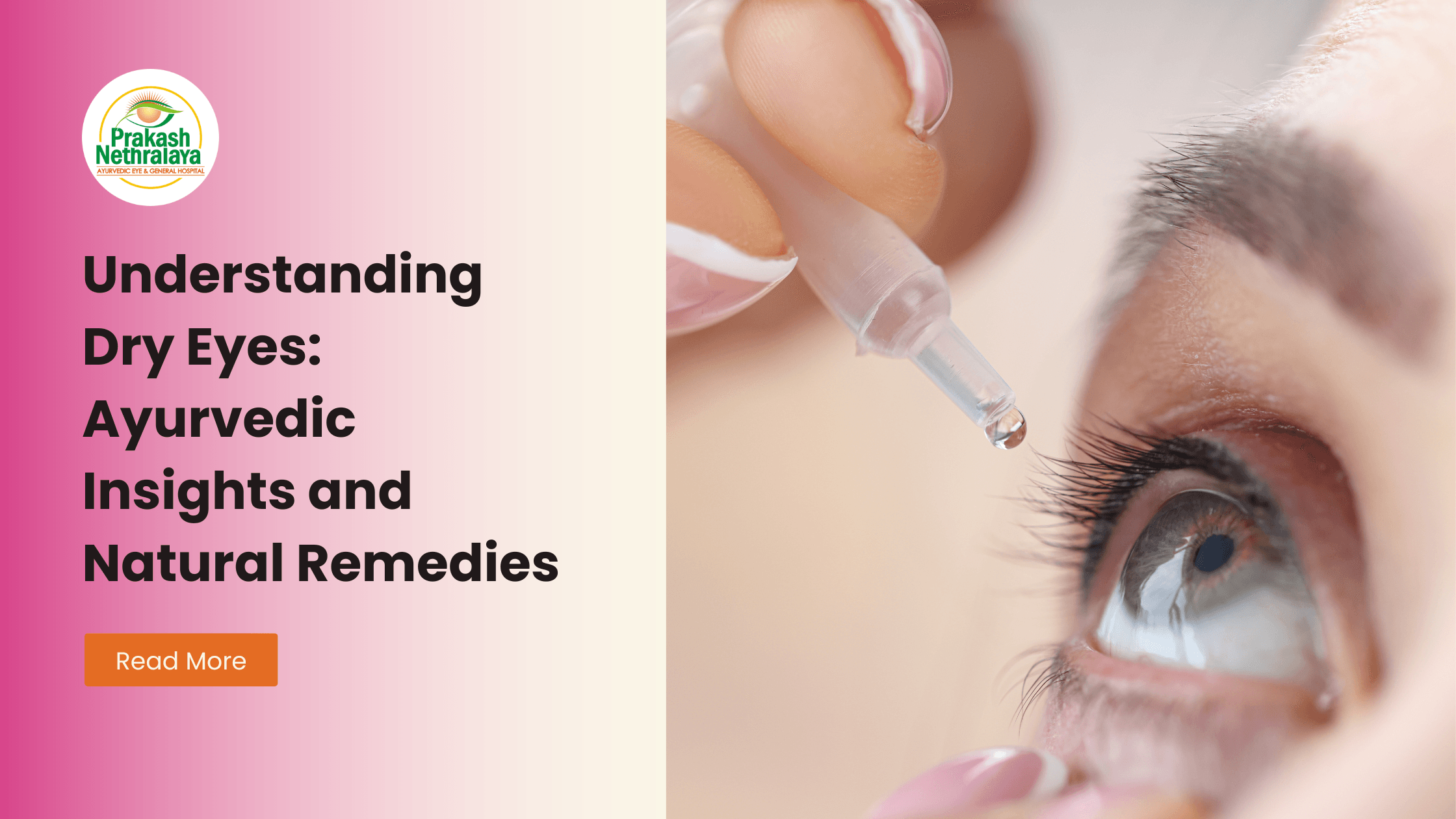 dry eyes ayurvedic treatment insight and remedies