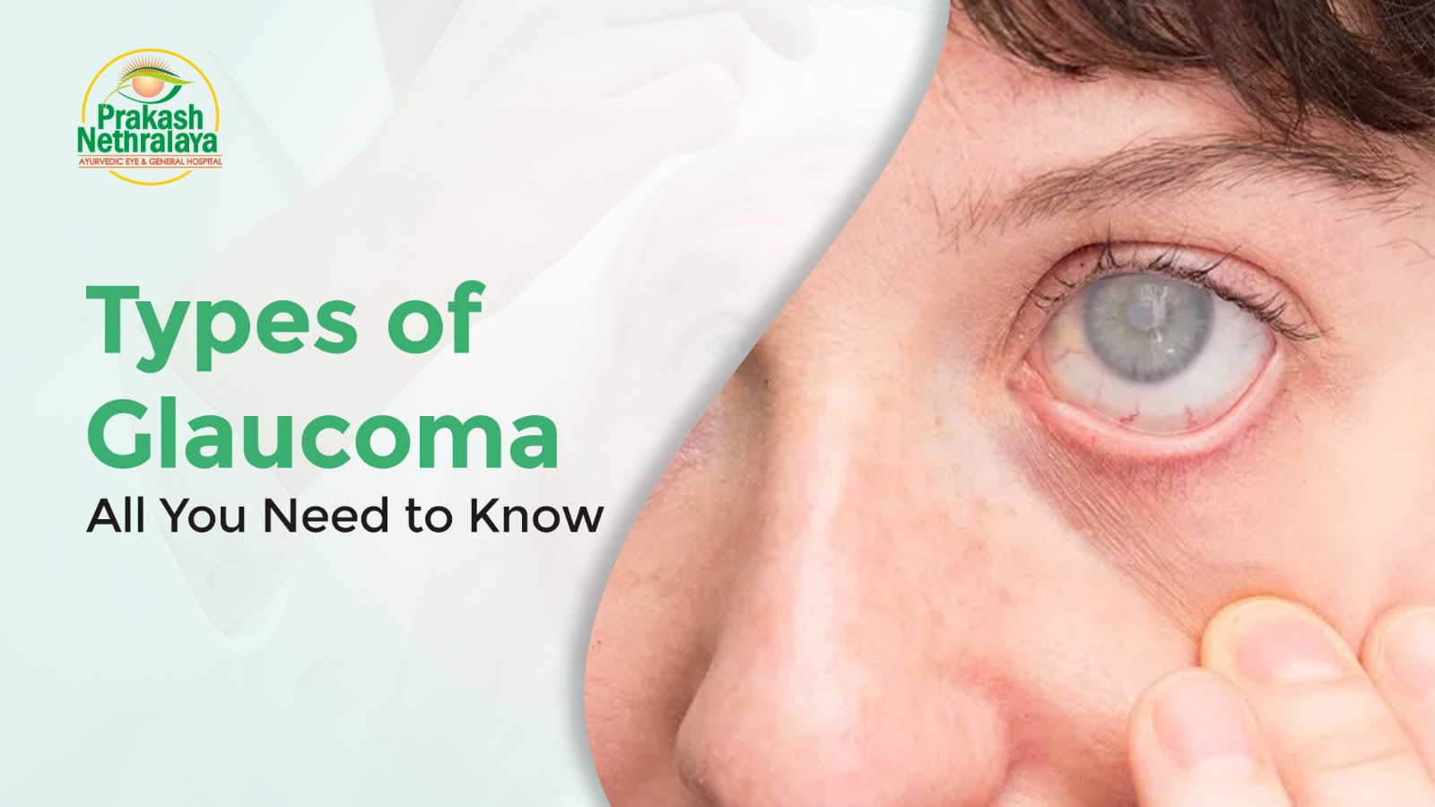 Types of Glaucoma