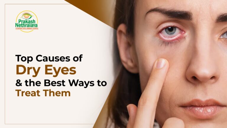 Top Causes of Dry Eyes and the Best Ways to Treat Them